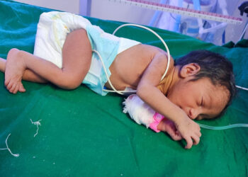 नवजात शिशुओं की थमने लगी सांसे तो चिरंजीवी योजना बनी संजीवनी